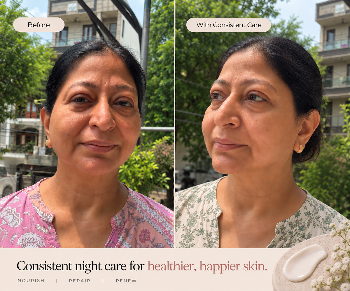 Beauty Sleep - Revitalizing Night Cream (with Hyaluronic Acid, Evening Primrose & Kokum Butter) 50g