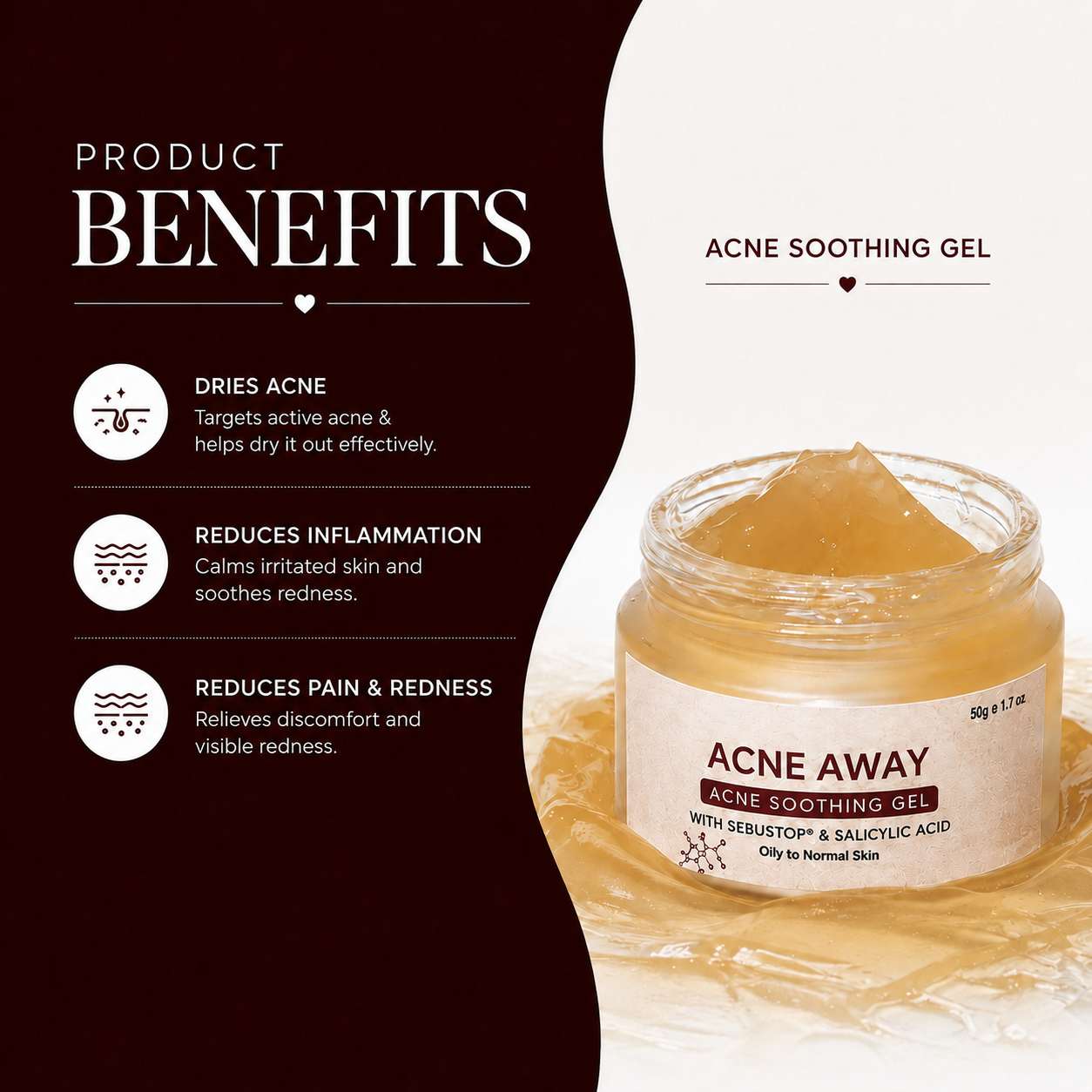 Acne Away - Acne Soothing Gel with Sebustop(R) & Salicylic Acid - 50gm (Oily/Acne Prone Skin)