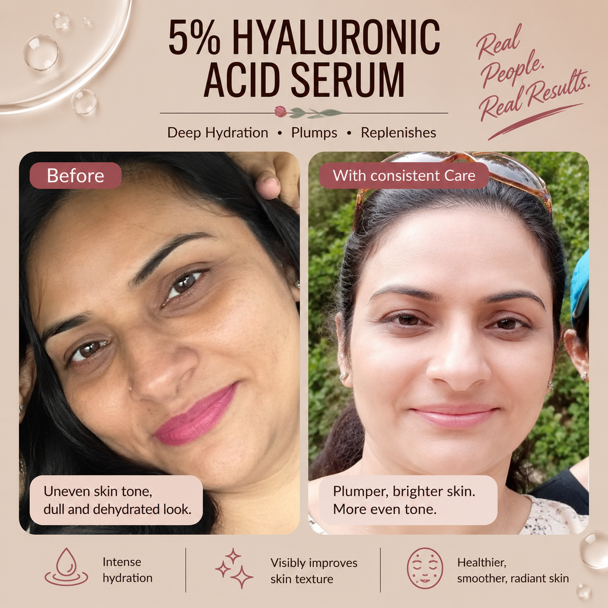 5% Hyaluronic Acid Serum - 30ml