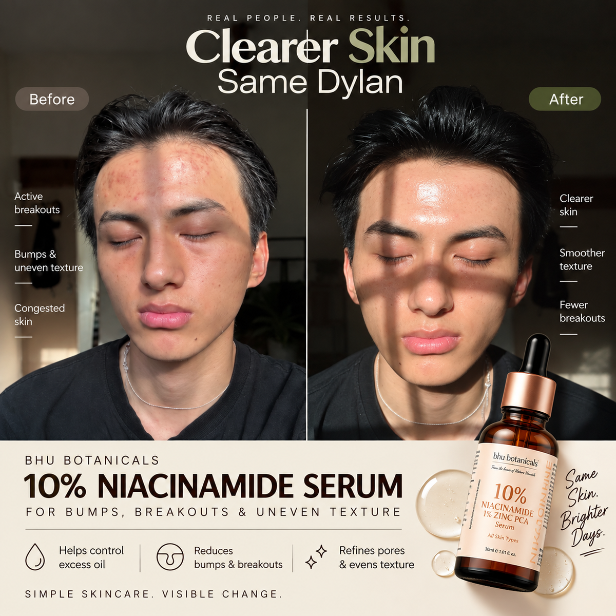 10% Niacinamide Serum -  30ml